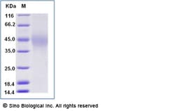 Sino Biological Recombinant Human TIM-3/HAVCR2 Protein (ECD, His Tag),