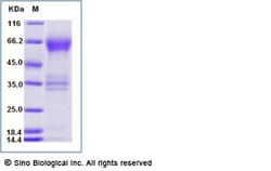 Sino Biological Recombinant Human TIM-3/HAVCR2 Protein (ECD, hFc Tag),
