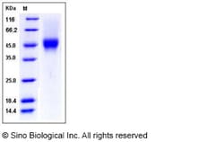 Sino Biological Recombinant Human CD16a/FCGR3A/Fc gamma RIIIA Protein (F176,