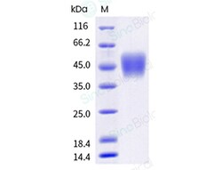 Sino Biological Recombinant Human CD16a/FCGR3A/Fc gamma RIIIA Protein (F176,