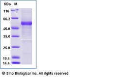 Sino Biological Recombinant Human LIGHT/TNFSF14 Protein (ECD, AVI & Fc