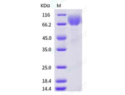 Sino Biological Recombinant Human TPO/Thrombopoietin Protein (His Tag),