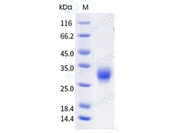 Sino Biological Recombinant Human CD32A/FCGR2A Protein (R167, His Tag),