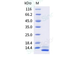 Sino Biological Recombinant Human IL-15 Protein, Quantity: Each of 1