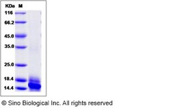 Sino Biological Recombinant Human IL-15 Protein (His Tag), Quantity: Each
