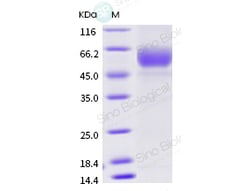 Sino Biological Recombinant Human TGF-beta RII/TGFBR2 Protein (ECD, His