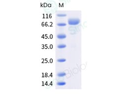 Sino Biological Recombinant Human IL-13 R alpha 2/IL13RA2 Protein (ECD,