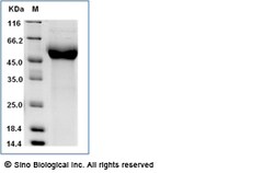 Sino Biological Recombinant Human IL-13 R alpha 2/IL13RA2 Protein (His