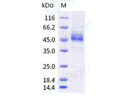 Sino Biological Recombinant Human ICOS Protein (ECD, hFc Tag), HPLC-verified,