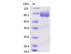 Sino Biological Recombinant Human IFNGR1 Protein (ECD, hFc Tag), Quantity:
