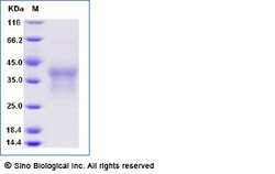Sino Biological Recombinant Human HVEM Protein (His Tag), Amine-Labeled