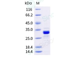 Sino Biological Recombinant Human HMGB1 Protein (His & AVI Tag), Biotinylated,