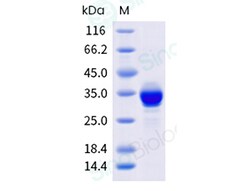 Sino Biological Recombinant Human HMGB1 Protein (His Tag), HPLC-verified,