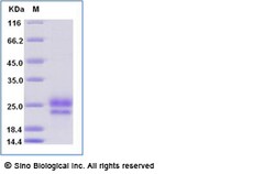Sino Biological Recombinant Human Fibronectin Protein (His Tag), HPLC-verified,