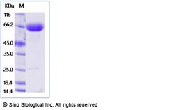 Sino Biological Recombinant Human PD-L2/B7-DC Protein (ECD, mFc Tag), Quantity: