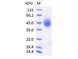 Sino Biological Recombinant Human PD-L2/B7-DC Protein (ECD, His & AVI Tag),
