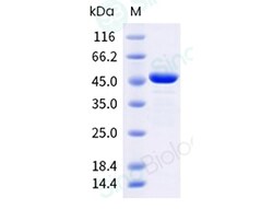 Sino Biological Recombinant Human Galectin-3/LGALS3 Protein (GST Tag),
