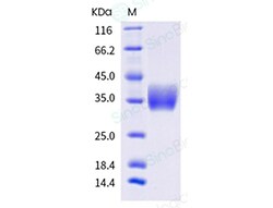 Sino Biological Recombinant Human Galectin-3/LGALS3 Protein (His Tag),