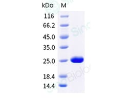 Sino Biological Recombinant Human Prolactin Protein, HPLC-verified, Quantity: