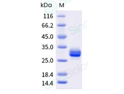 Sino Biological Recombinant Human Noggin/NOG Protein, HPLC-verified, Quantity: