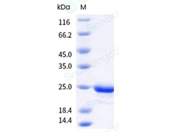 Sino Biological Recombinant Human FGF-9 Protein, HPLC-verified, Quantity: