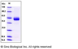 Sino Biological Recombinant Human CD23 Protein (His Tag), Quantity: Each