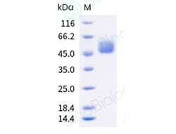 Sino Biological Recombinant Human CD64/FCGR1 Protein (ECD, His Tag), HPLC-verified,