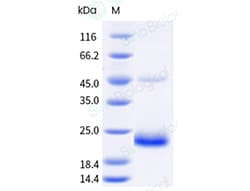 Sino Biological Recombinant Human Dectin-2/CLEC6A Protein (ECD, His Tag),