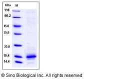 Sino Biological Recombinant Human MIF Protein (His Tag), MALS-verified，Trimer,