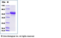 Sino Biological Recombinant Human CD40 Ligand/TNFSF5 Protein (ECD, hFc