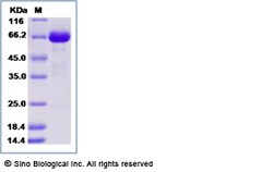 Sino Biological Recombinant Human EphB4 Protein (His Tag), Amine-Labeled