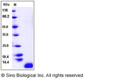 Sino Biological Recombinant Human TARC/CCL17 Protein, Quantity: Each of