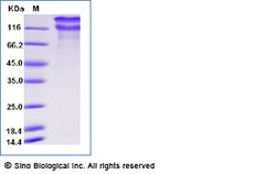 Sino Biological Recombinant Human LDLR/LDL Receptor Protein (His Tag),