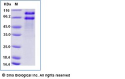 Sino Biological Recombinant Human ADAM8/CD156a Protein (ECD, His Tag),