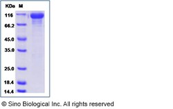 Sino Biological Recombinant Human HER3/ERBB3 Protein (His Tag), Amine-Labeled