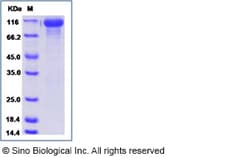 Sino Biological Recombinant Human HER3/ERBB3 Protein (His Tag), Amine-Labeled
