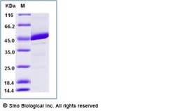 Sino Biological Recombinant Human HARS/HisRS Protein (His Tag), Quantity: