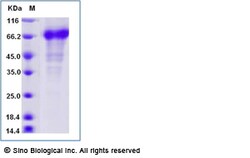 Sino Biological Recombinant Human DKK-1 Protein (hFc Tag), Quantity: Each