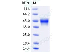 Sino Biological Recombinant Human CD25/IL-2R alpha Protein (ECD, His &