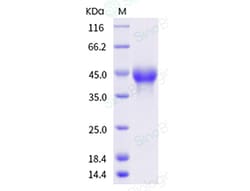 Sino Biological Recombinant Human CD25/IL-2R alpha Protein (ECD, His Tag),