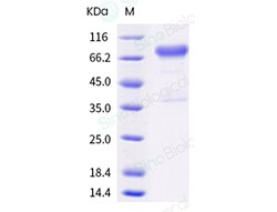Sino Biological Recombinant Human CD25/IL-2R alpha Protein (ECD, hFc Tag),