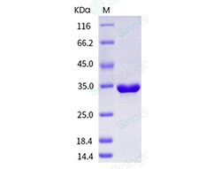 Sino Biological Recombinant Human IL-1 beta Protein (pro form, His Tag),