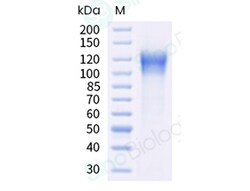 Sino Biological Recombinant Human VEGFR1/FLT1 Protein (ECD, His Tag), HPLC-verified,
