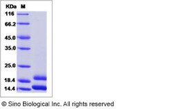 Sino Biological Recombinant Human MCP-1/CCL2 Protein (His Tag), Quantity: