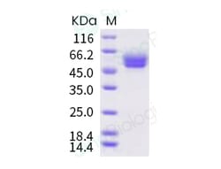 Sino Biological Recombinant Human IL1R1 Protein (ECD, His Tag), HPLC-verified,