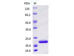 Sino Biological Recombinant Human IL-1RA/IL-1RN Protein, Quantity: Each