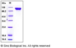 Sino Biological Recombinant Human CD146/MCAM Protein (His Tag), Quantity:
