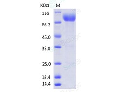 Sino Biological Recombinant Human CD155/PVR Protein (ECD, hFc Tag), HPLC-verified,