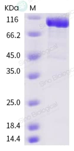 Sino Biological Recombinant Human ACE2 Protein (His & AVI Tag), Biotinylated,
