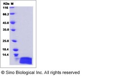 Sino Biological Recombinant Human IL-8/CXCL8 Protein (aa 28-99), Quantity: